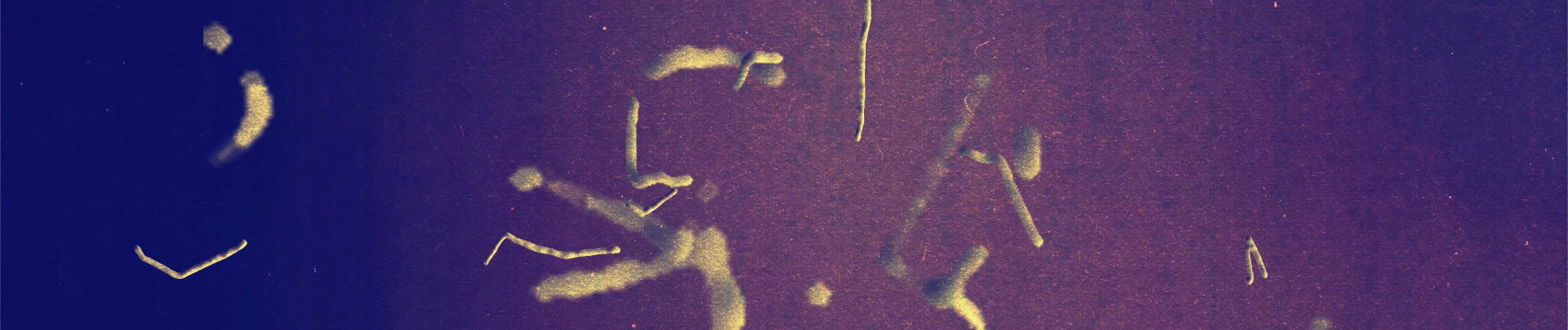 The State of Things official artwork